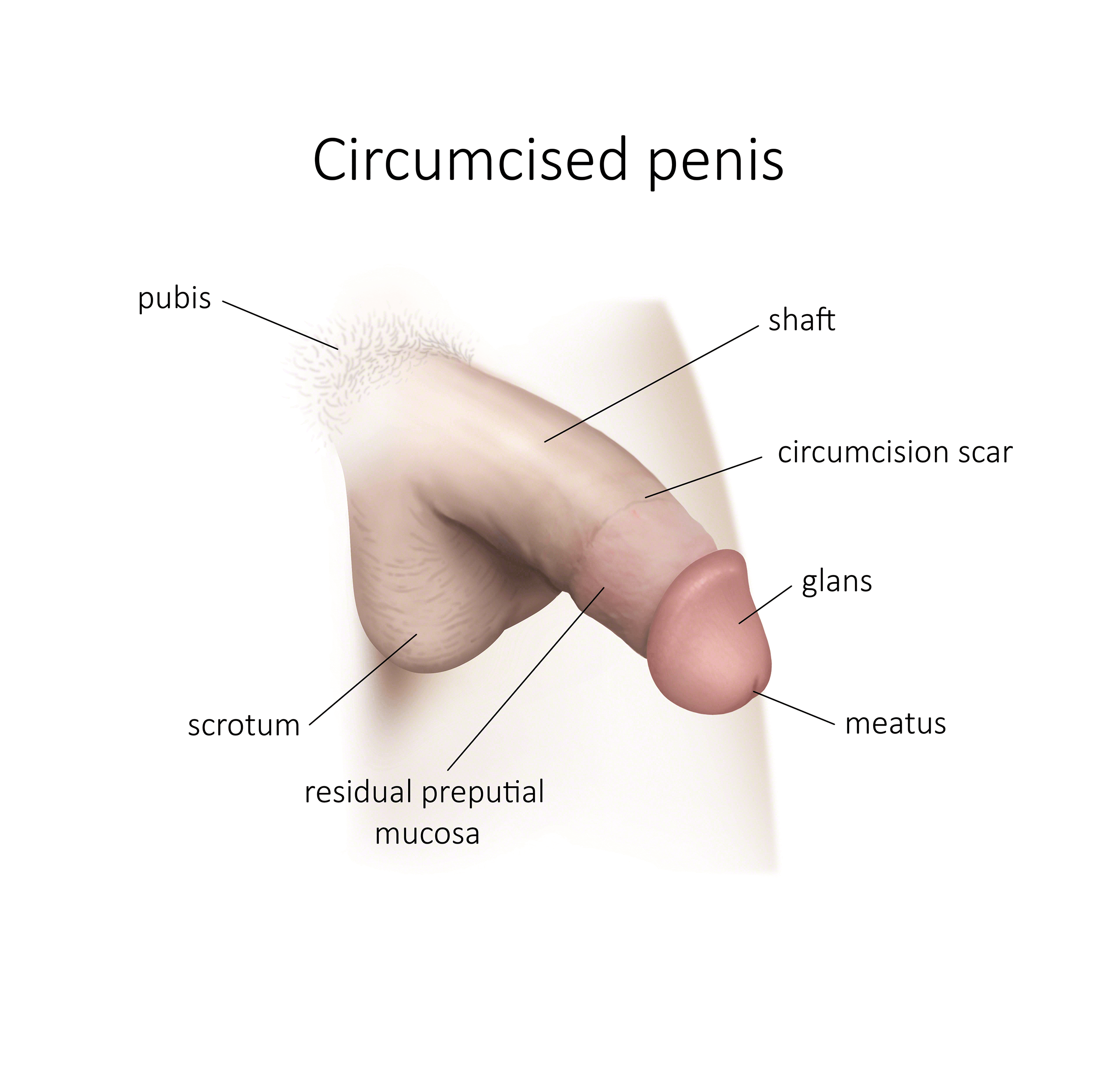  penis circumcised