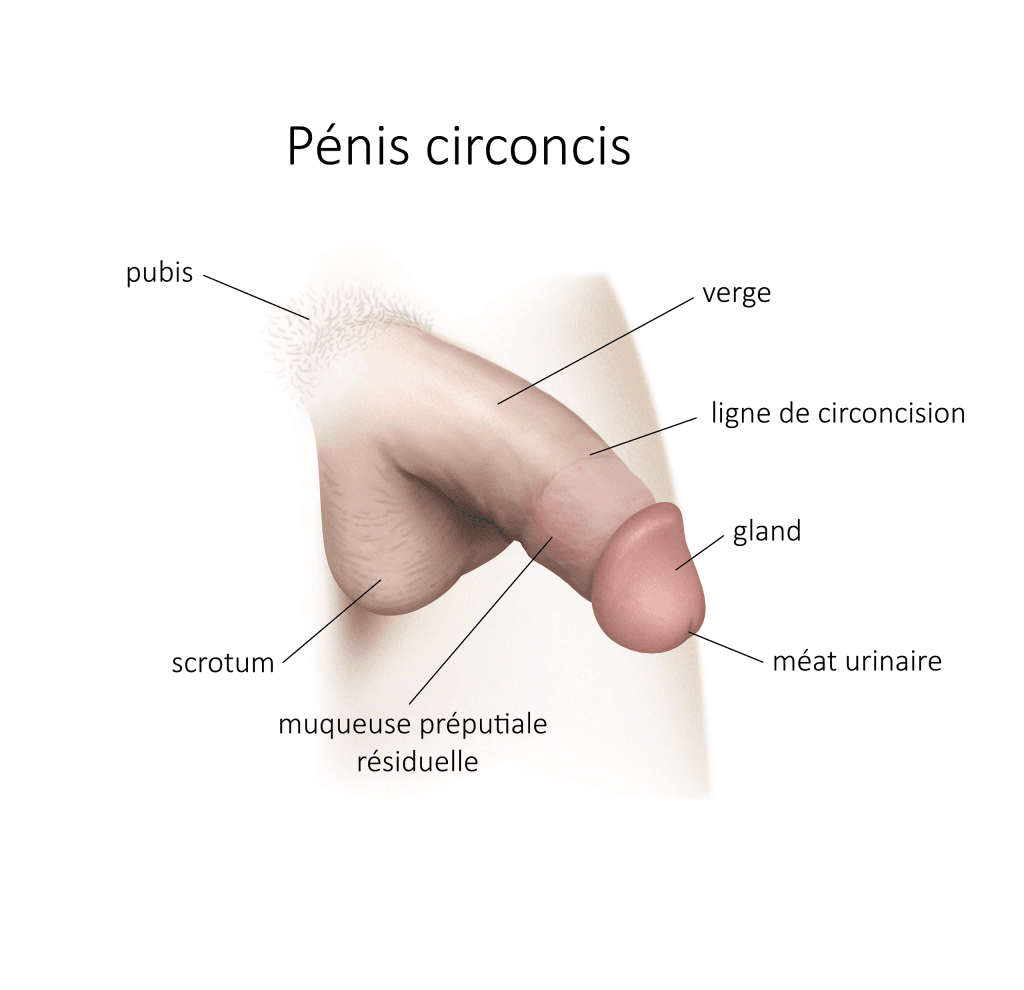 penis circoncis