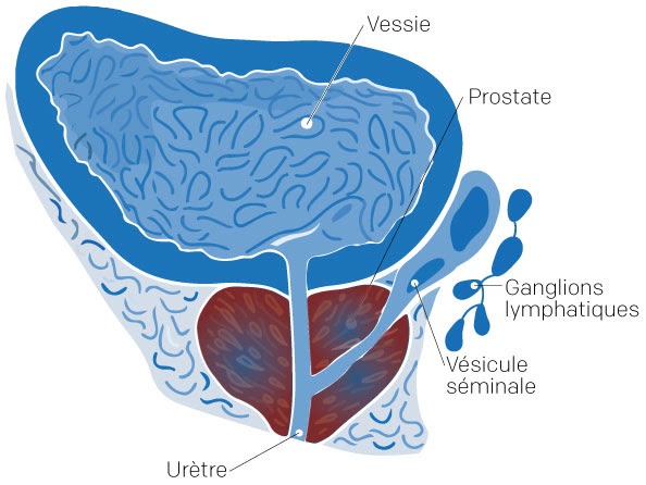 coupe transversale prostate et vessie